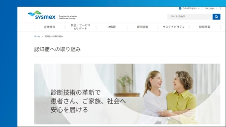 シリーズ：アルツハイマー治療を考える③ アルツハイマー病で注目される&ldquo;アミロイド&beta;&rdquo;とは