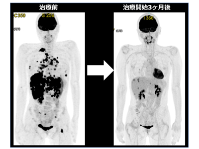 画像: 画像はリリースより